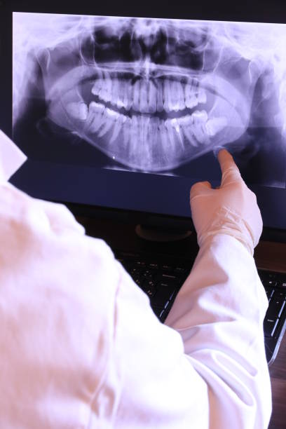 Best Dentist for Tooth Abscess  in Tyro, NC
